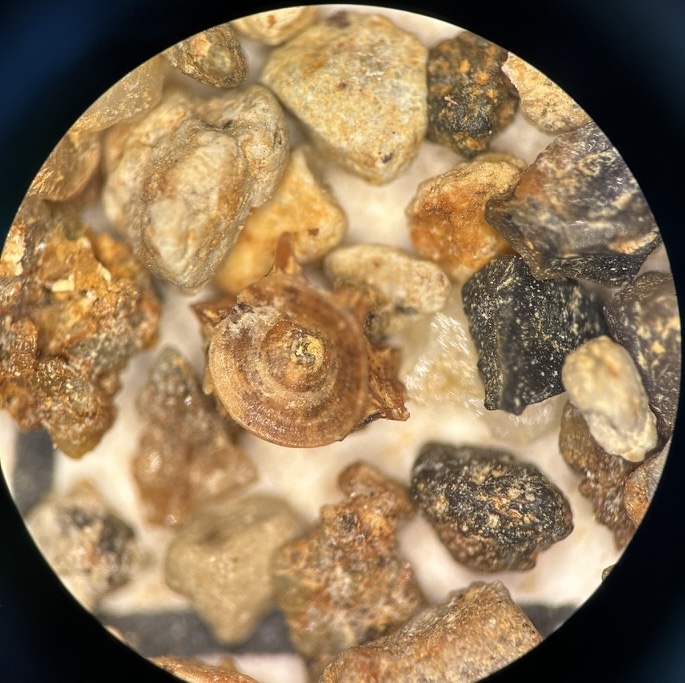 Fish centrum (vertebra), frontal view